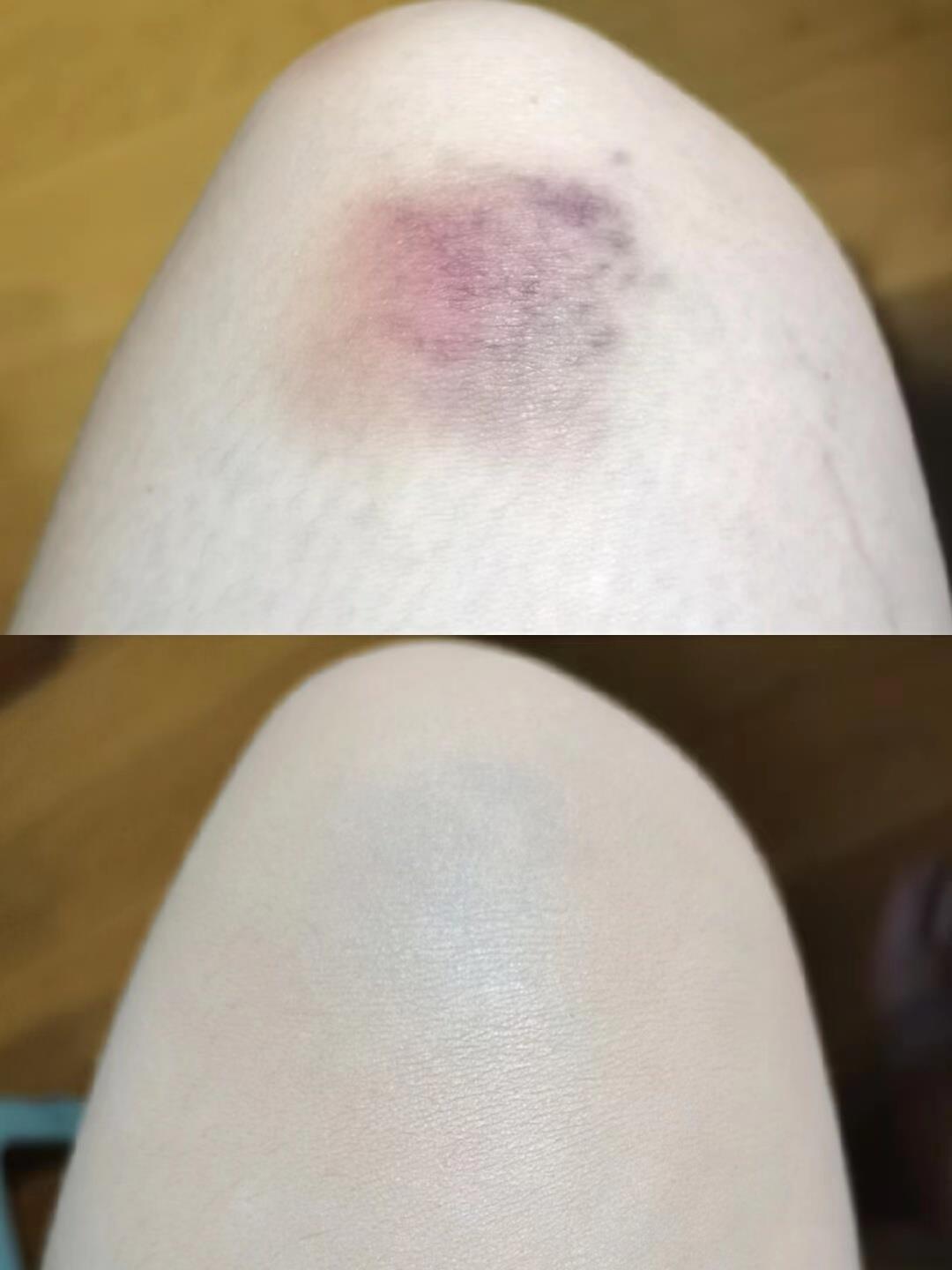 遮瑕排行榜前十名全部（全球遮瑕膏排行榜10强）