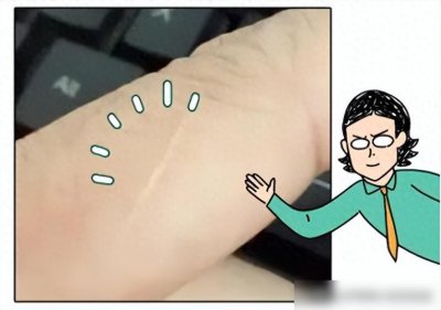 ​为啥很多人的左手食指上，都有一道疤？
